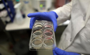 Les Etats-Unis ont pour la seconde fois donné le feu vert à un essai clinique avec des dérivés de cellules souches embryonnaires humaines, une thérapie prometteuse mais controversée, cette fois pour traiter une maladie infantile héréditaire et irréversible de l'oeil.