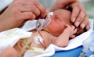 Un bébé prématuré à la naissance