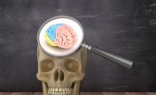 Une activité électrique perdure dans le cerveau dans les 10 minutes qui suivent l'arrêt cardiaque (illustration).