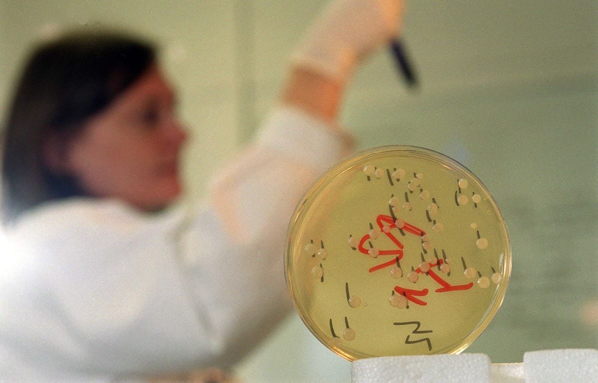 Listeria : Quels sont les symptômes de la listériose ?