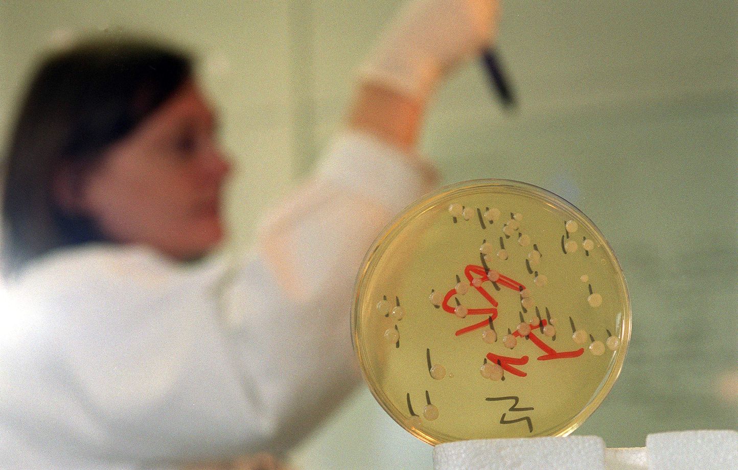 Listeria : Quels sont les symptômes de la listériose ?