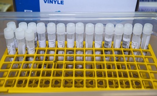 Illustration d'analyses de tests PCR effectués dans le cadre de l'épidémie de Covid-19.