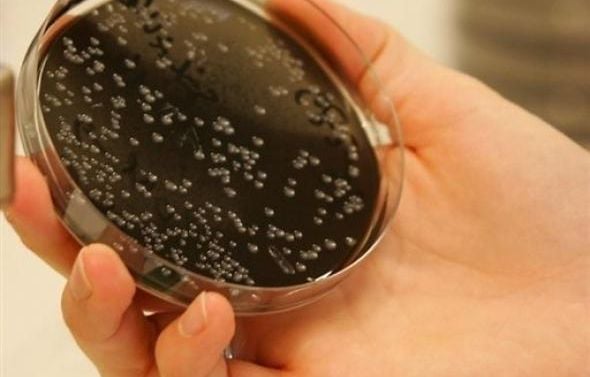 Légionellose : Un mort et cinq personnes hospitalisées en Savoie, l'origine de la contamination inconnue