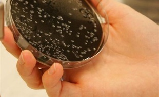 Deux cas de légionellose ont été diagnostiqués en fin de semaine dans les Alpes-de-Haute-Provence dans la partie piscine-sauna d'une résidence hôtelière à Uvernet-Fours, a-t-on appris vendredi soir auprès de la préfecture.