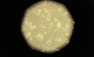 Le document fait la liste de toutes les techniques biomédicales qu'il juge "illicites", de la fécondation in vitro au clonage ou à l'utilisation de cellules souches embryonnaires pour soigner ou fabriquer des vaccins, en passant par la pilule du lendemain.