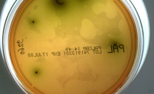 Gros plan d'une souche de listeria