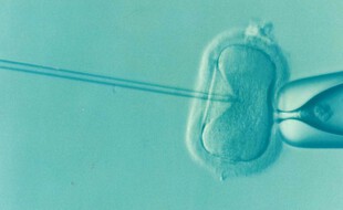 Illustration d'une fécondation in vitro.