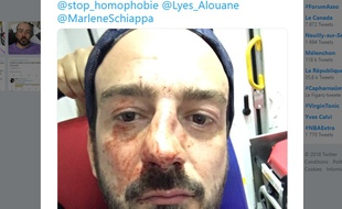 Guillaume Mélanie a été victime d'une agression homophobe ce mardi soir