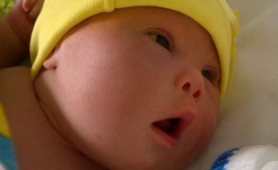 Le petit Leo, atteint de trisomie 21.