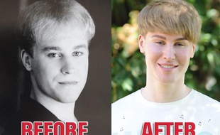 Un fan de Justin Bieber multiplie les opérations de chirurgie esthétique pour lui ressembler.