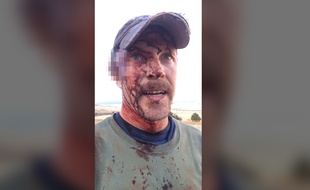 Todd Orr a survécu à l'attaque d'un ours et de ses deux enfants aux États-Unis.