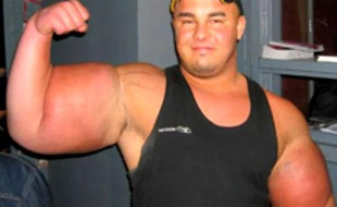 Du Synthol plein les bras