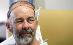 James Boysen, qui a été opéré le 22 mai 2015, est le premier patient greffé du crâne et du cuir chevelu