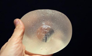 Les autorités sanitaires présenteront vendredi leurs recommandations sur la prise en charge des dizaines de milliers de femmes porteuses de prothèses mammaires PIP, et pourraient conseiller un retrait systématique de ces implants.