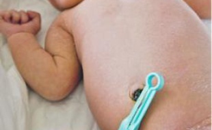 Le sang du cordon ombilical de 750 bébés a été prélevé.
