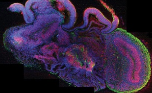 Un mini-cerveau créé en laboratoire par une équipe de cherhceurs autrichiens en 2013