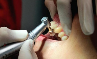 Le lobby sucrier aux Etats-Unis s'est employé dans les années 60 à empêcher que la lutte contre les caries dentaires chez les enfants soit associée à une réduction de la consommation de sucre, selon une étude
