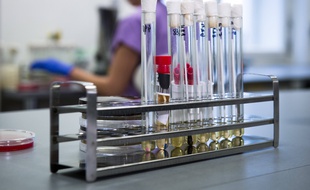 Un laboratoire de l'hôpital Bulovce de Prague, lors d'une conférence de presse sur le coronavirus, le 27 janvier 2020.