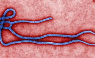 Le virus Ebola vu sous un microscope