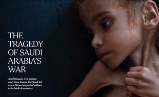 Amal Hussain, 7 ans, est morte de malnutrition au Yémen