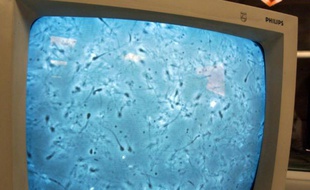 Des chercheurs lyonnais ont réussi à créer des spermatozoïdes in vitro à partir de cellules souches testiculaires. Une première mondiale, selon eux