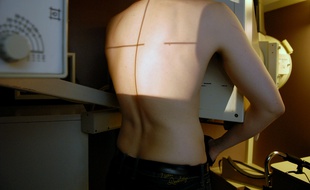 Opération de dépistage de la tuberculose