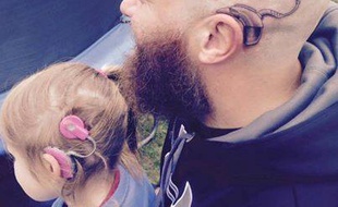 Pour soutenir sa fille sourde, Alistair Campbell s'est fait tatouer le même implant cochléaire que sa fille. La photo a fait le tour du Web.