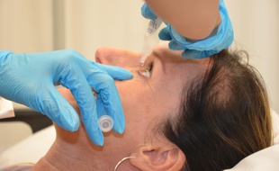 Une femme en train de recevoir des gouttes dans les yeux (illustration).