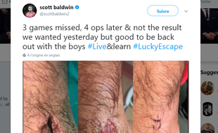 Scott Baldwins a eu chaud, très chaud, après la morsure du lion.