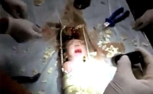 Capture d'écran de la vidéo montrant le sauvetage d'un nourrisson, coincé dans une conduite d'évacuation des eux usées en Chine, le 25 mai 2013.