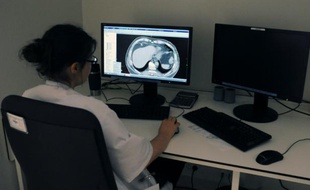 Un médecin regarde une radio des poumons à l'Institut universitaire du cancer, à Toulouse, le 4 juin 2015