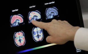 Un chercheur observe des scanners du cerveau à Phoenix (Etats-Unis)