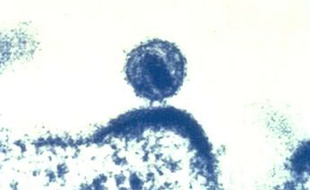 Le virus du sida infecte une cellule humaine.