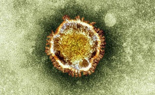 A electron microscope image of a coronavirus is seen in this undated picture provided by the Health Protection Agency in London February 19, 2013. A new virus that emerged in the Middle East last year and has killed five people is well adapted to infecting humans but could potentially be treated with drugs that boost the immune system, scientists said.