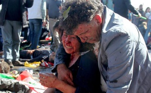 Une femme blessée dans une double explosion meutrière le 10 octobre 2015 à Ankara