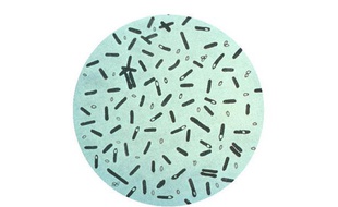 Photographie au microscope de bactéries Clostridium botulinum.