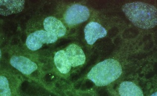 Des transplantations de cellules souches dans les muscles des pattes de souris ont empêché la réduction de leur masse musculaire, qui se produit normalement avec l'âge, selon une étude de chercheurs américains dévoilée mercredi.