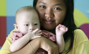 Pattaramon Chanbua, 21 ans, pose avec son fils, Gammy, trisomique, à l'hôpital de la province de Chonburi, en Thaïlande, le 3 août 2014. (AP Photo/Apichart Weerawong)/AW106/135584759221/1408030707