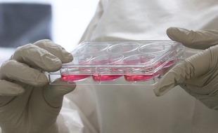 SALT LAKE CITY, UT - OCTOBER 14: Amanda Smith, graduate student from the University of Utah, holds a container with test material in a sealed lab with a non-infective forum of the Ebola virus to help discover a drug that is effective against a part of Ebola that is vulnerable to drugs, on October 14, 2014 in Salt Lake City, Utah. Dr. Michael Kay says this breakthrough if proven to be effective, won't help the current outbreak of Ebola but they hope it will be able to prevent the next one in the coming years on all the strains of Ebola not just one. George Frey/Getty Images/AFP
== FOR NEWSPAPERS, INTERNET, TELCOS & TELEVISION USE ONLY ==