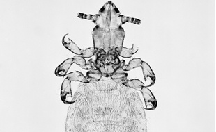 Illustration d'un poux