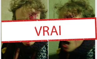 Les photos virales du doctorant blessé par les forces de l'ordre, le 21 janvier 2020.