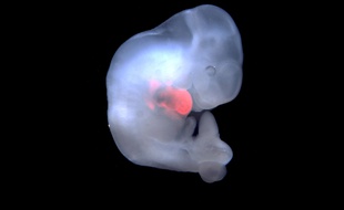 Un embryon chimérique de cochon contenant des cellules humaines, créé par des chercheurs de l'Université de San Diego.