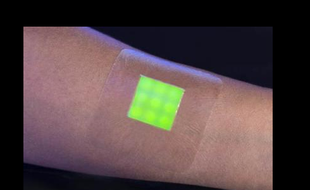 Des chercheurs britanniques ont mis au point un pansement intelligent capable de changer de couleur pour révéler la présence de bactérie, ici le staphylocoque doré.
