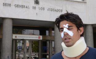 Thomas Drouet le 6 mai 2013 à Madrid, après avoir été agressé par le père de Bernard Tomic.