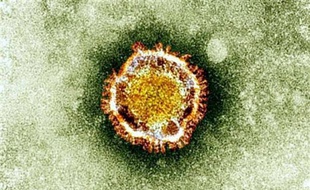 Deux personnels de santé saoudiens ont été infectés par le nouveau coronavirus proche du SRAS dont des patients hospitalisés étaient porteurs, a indiqué mercredi l'Organisation mondiale de la santé (OMS).