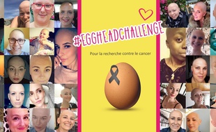 Des femmes atteintes d'un cancer ont posté leur photo et lancé le #EggHeadChallenge.