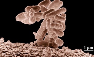 La bactérie Escherichia coli (E-coli).