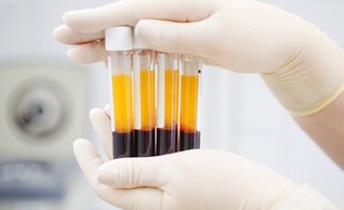Tubes de sang en deux couches - cellules sanguines en bas et plasma des plaquettes en haut - après passage dans une centrifugeuse