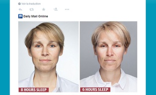 En une semaine, la journaliste britannique Sarah Chalmers a constaté les effets du manque de sommeil sur sa peau.