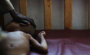 Un bébé éthiopien mal nourri, dans une unité de soins intensifs d'un dispensaire de Médecins Sans Frontières (MSF) dans la localité de Kuyera (Ethiopie), le 2 septembre 2008